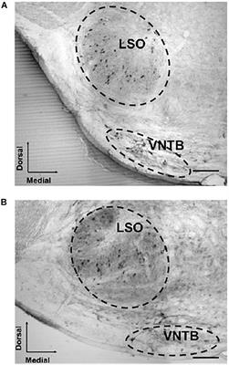Olivocochlear Changes Associated With Aging Predominantly Affect the Medial Olivocochlear System